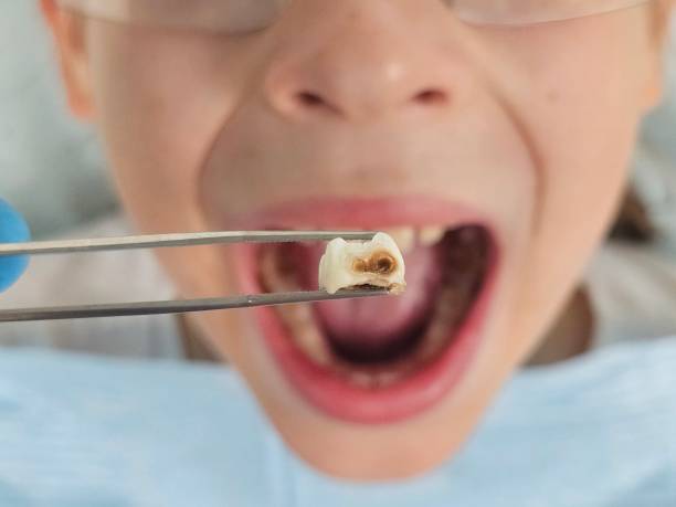 Best Pediatric Emergency Dentist in Ntgomery City, MO